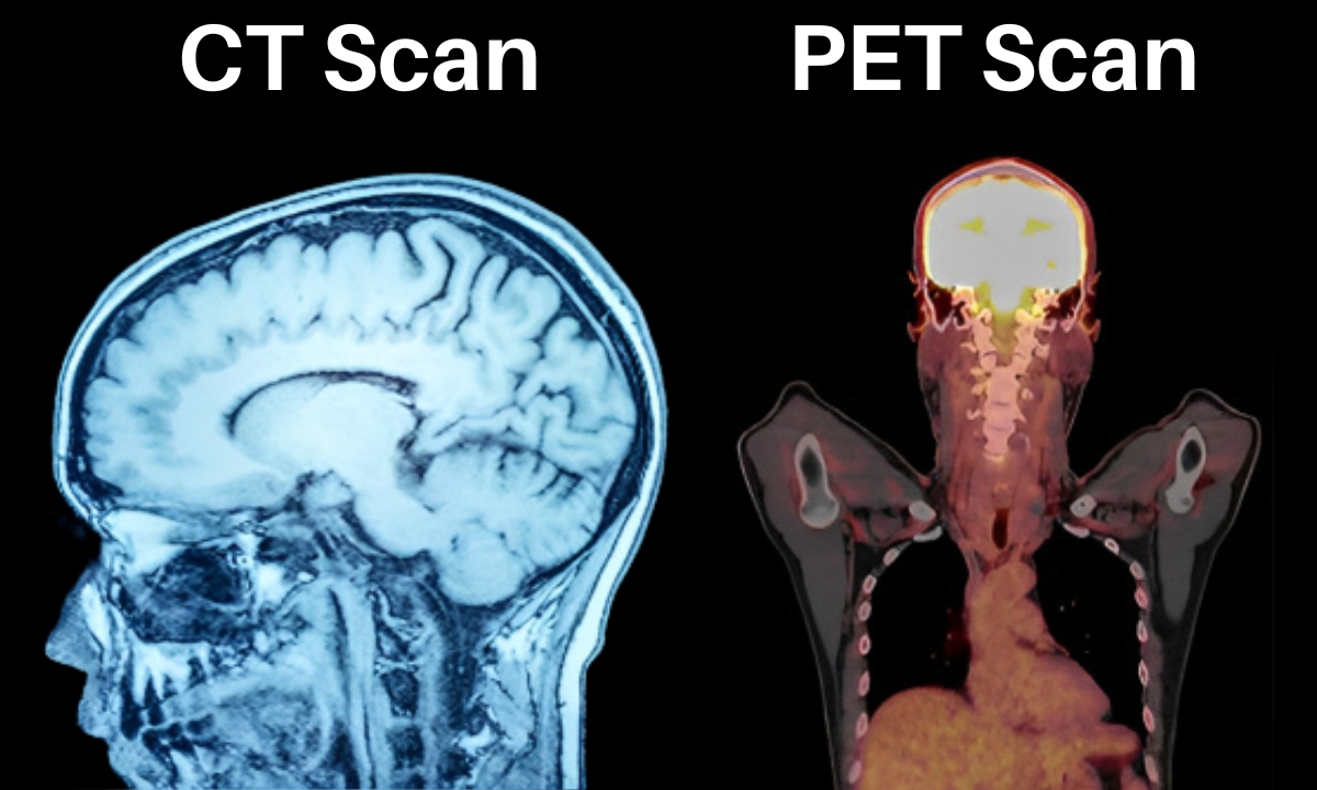CT Scan VS PET Scan Difference