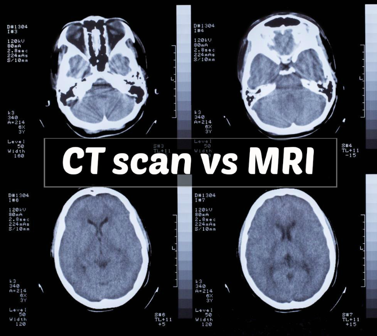 What Is The Difference Between MRI and CT scan